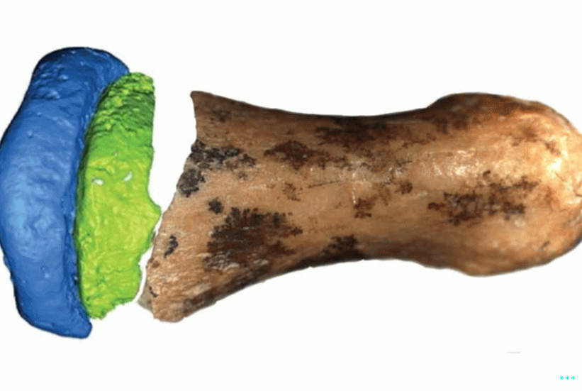 손가락 뼈의 일부 사진과 흰색 배경에 나머지 디지털 모델의 합성 이미지.